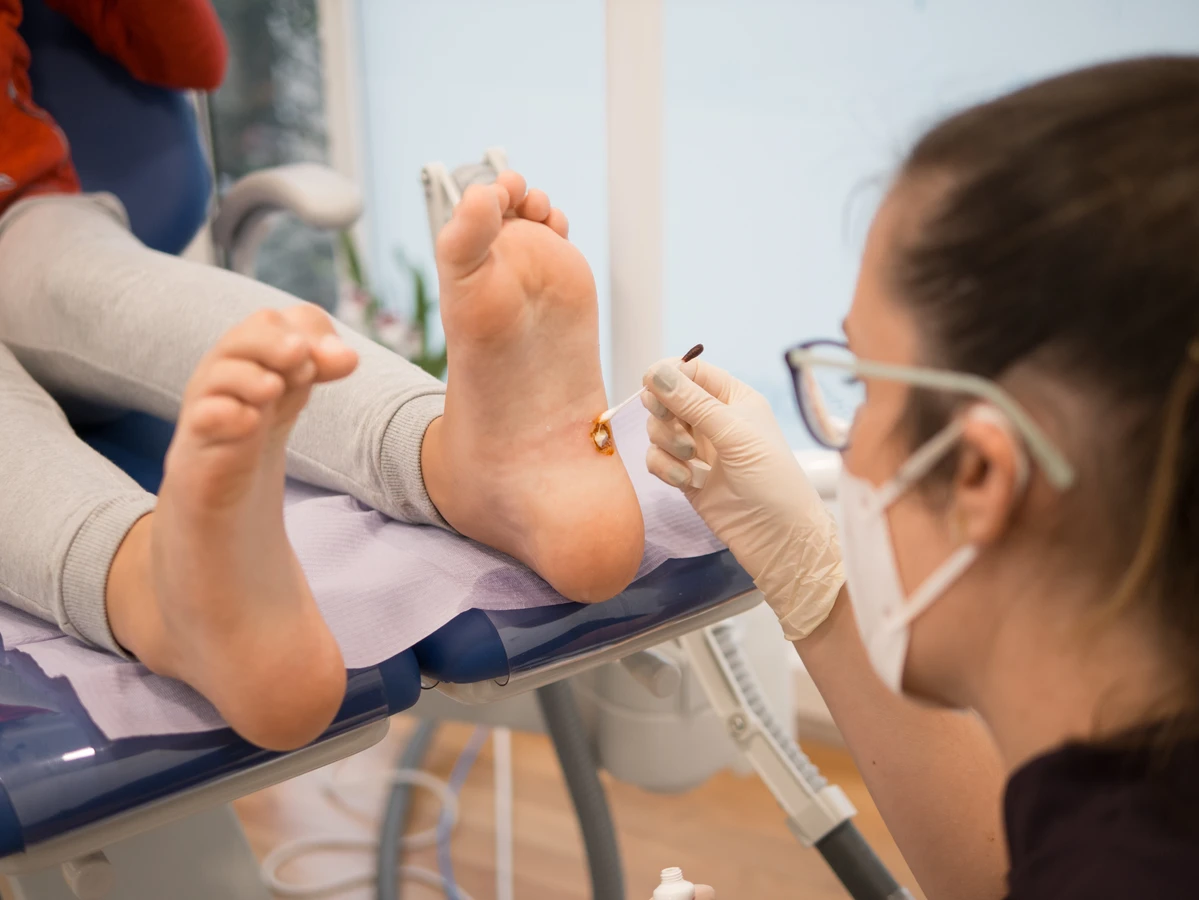 Czym jest pedicure leczniczy oraz na czym dokładnie polega?