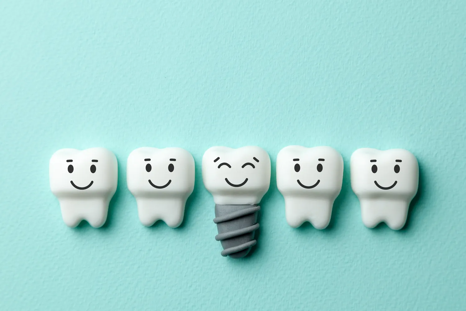 Implanty stomatologiczne Szczecin